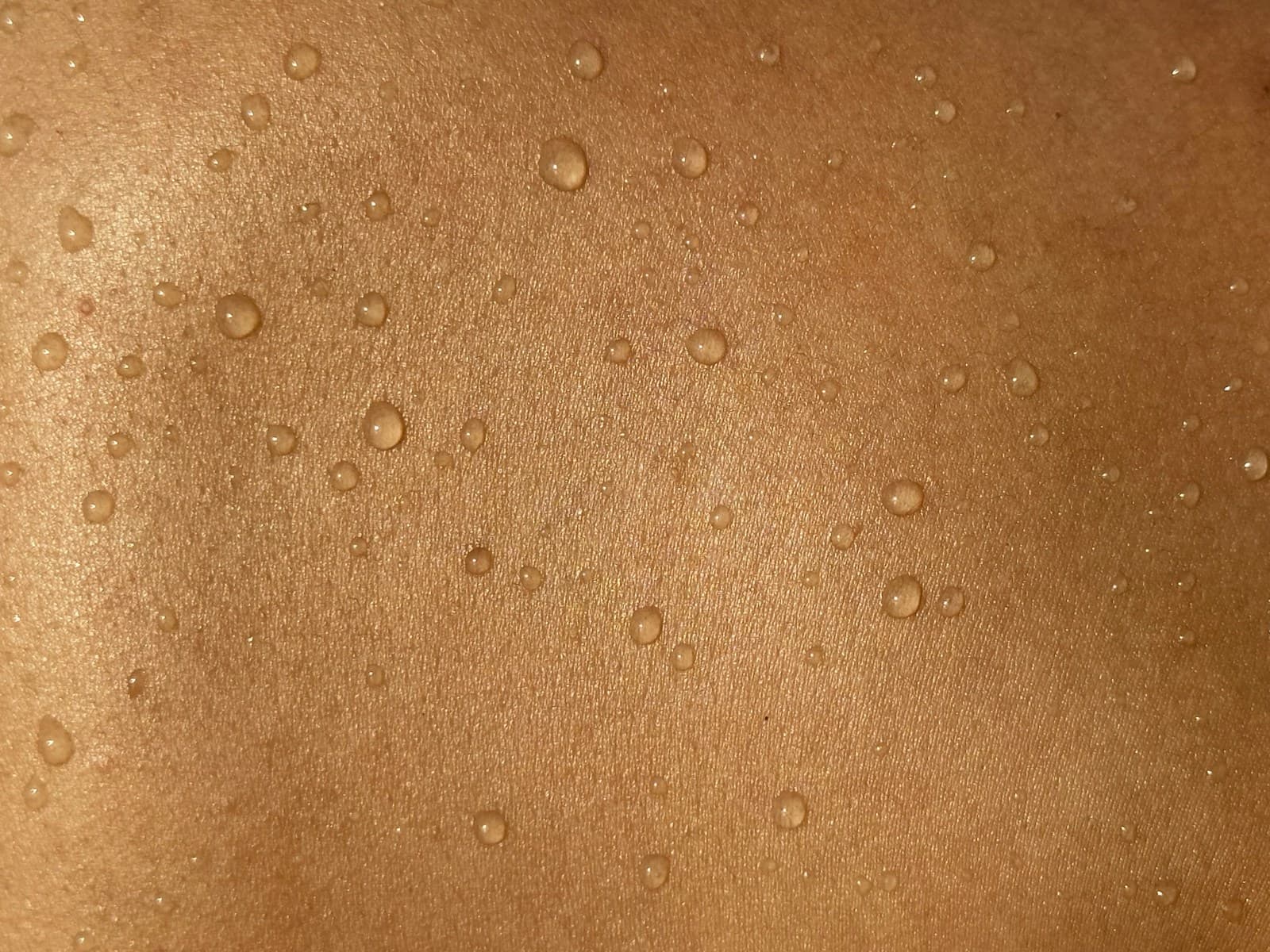 Moles & Skin Tags at Dr. Torun's Clinic